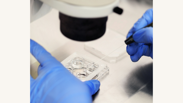 Understanding the Embryo Grading Process in IVF