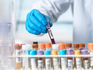 What Your First Fertility Bloodwork Results Actually Mean